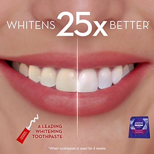 3d white strips luxe reviews