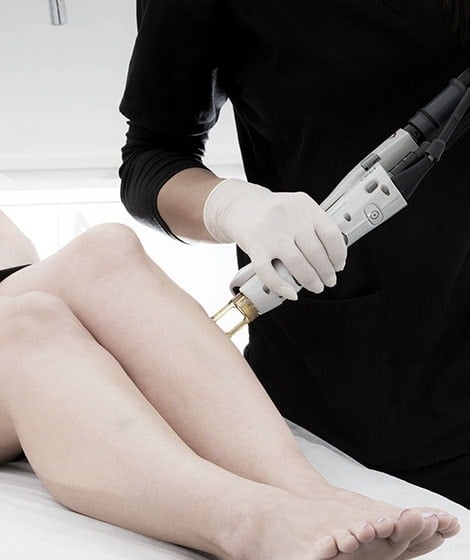 caci clinic laser hair removal reviews